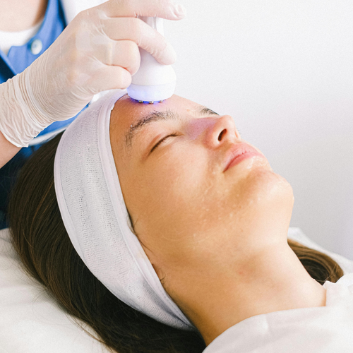 RADIOFRECUENCIA FACIAL (TENSAR PIEL)